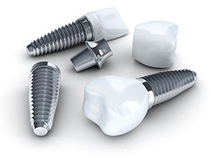 Components of dental implants in Frederick
