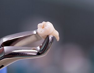 Forceps holding extracted tooth on gray background 