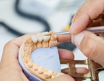 dental professional creating dental bridge 