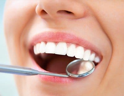 Closeup of smile during dental exam