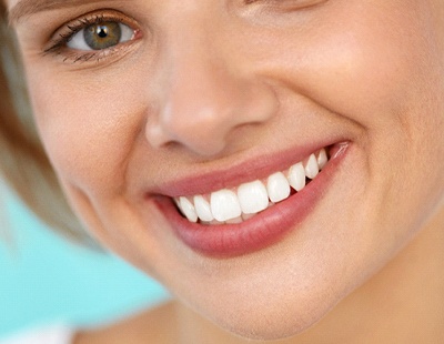close up of woman smiling after getting cosmetic dentistry in Frederick