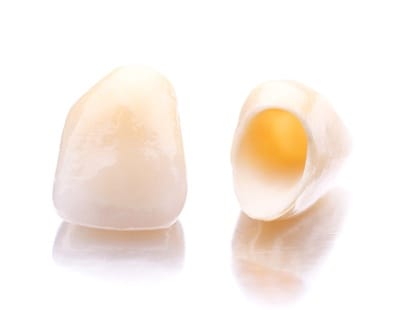 Dental crown in Frederick