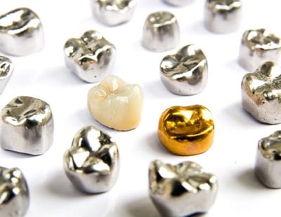 Varieties of dental crowns