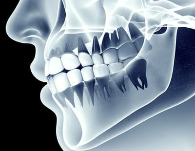  X-ray of a person’s jaws 