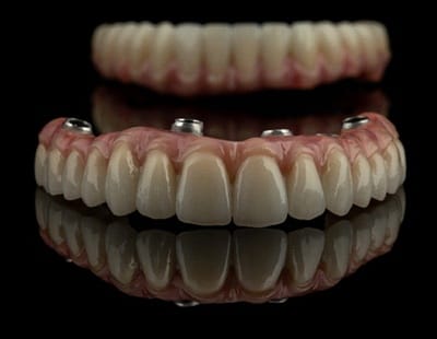 An image of a customized implant denture with multiple areas for it to attach to the implants