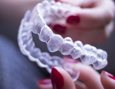 An Invisalign aligner