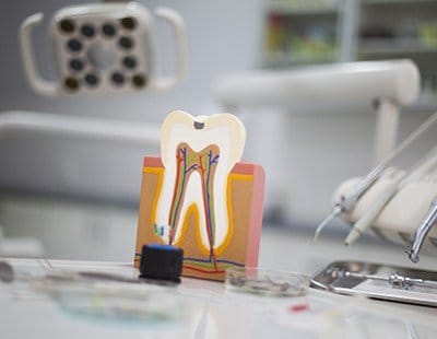 Model of the inside of the tooth