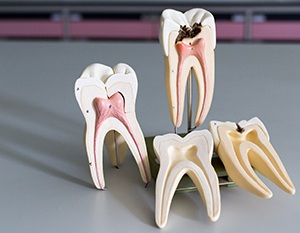 Four model teeth showing canals on gray desk 