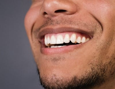man smiling teeth