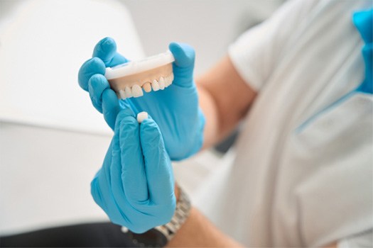 Gloved hands holding model teeth and dental crown