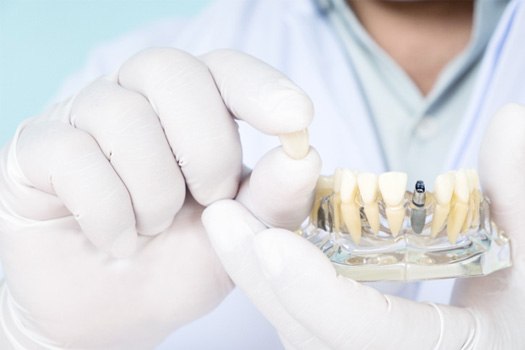 Gloved hands holding clear base with model teeth and sample dental implant