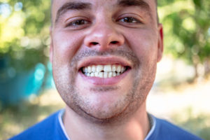 Man in blue shirt with a chipped tooth in Frederick
