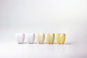 Row of teeth, some yellow and some white.